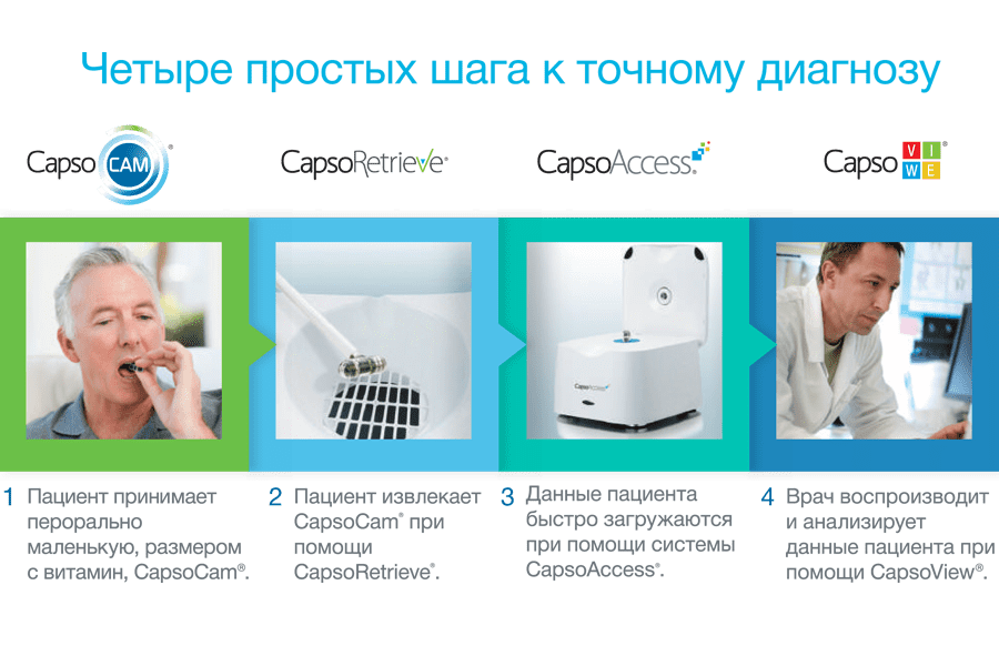 Капсульная эндоскопия: порядок проведения